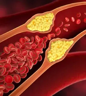 Effective Cholesterol Management: