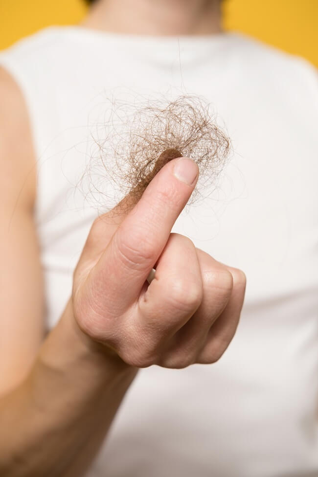Hair Loss Prevention: